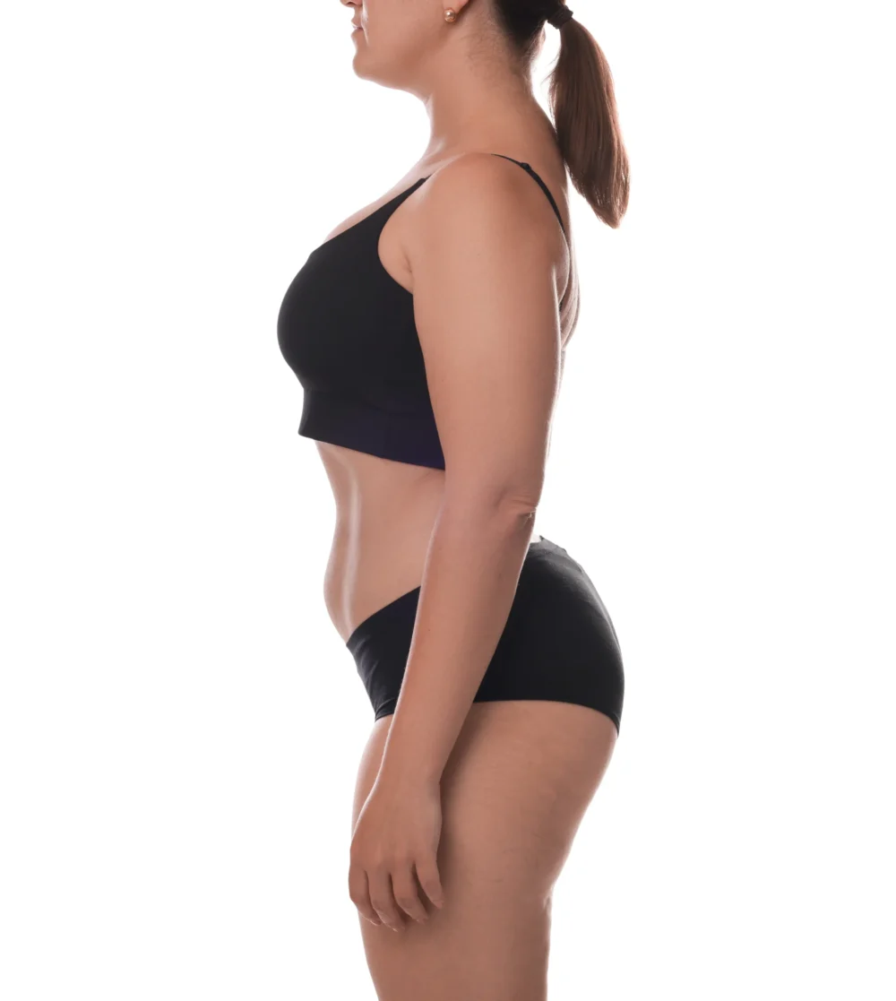 LIPO CON TRANSFERENCIA DE GRASA A MAMAS - COSMÉDICA