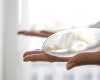 Encapsulamiento o contractura capsular en prótesis de pecho