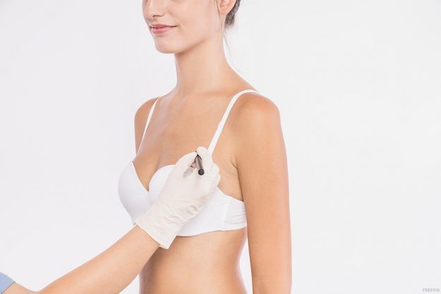 segunda intervención